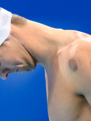 depressione phelps