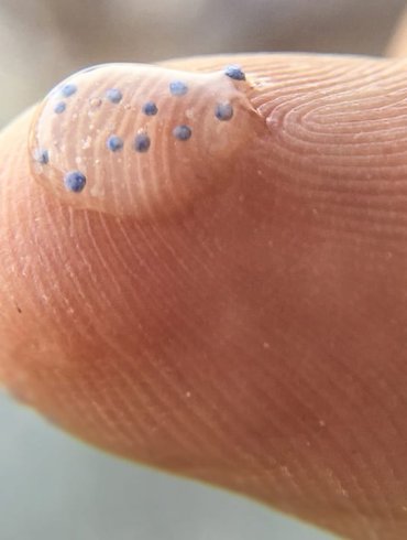 microplastiche nell'organismo