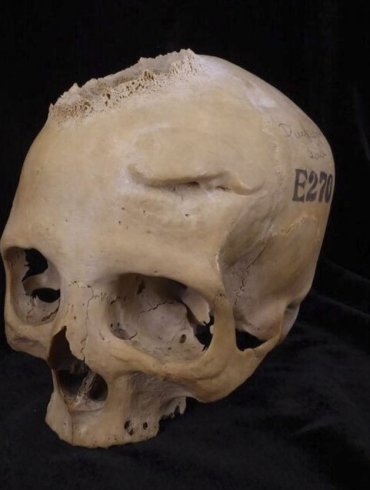 cancro antico egitto